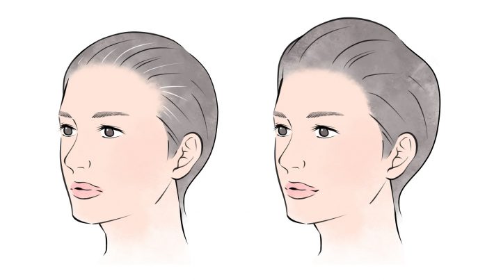 女性の髪の変化