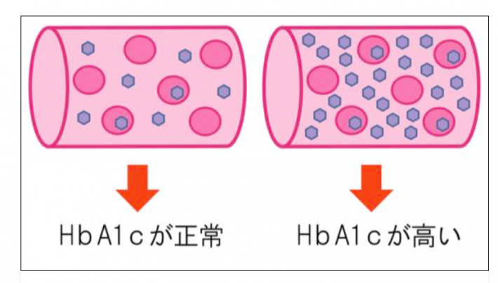ヘモグロビン２