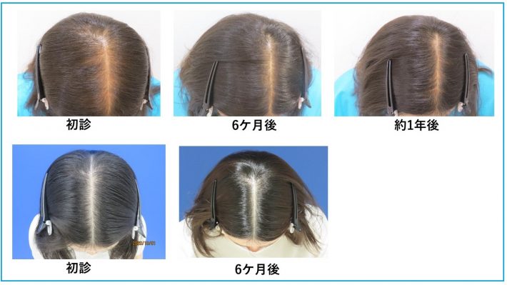 カウンセリング時に見せてもらった症例写真