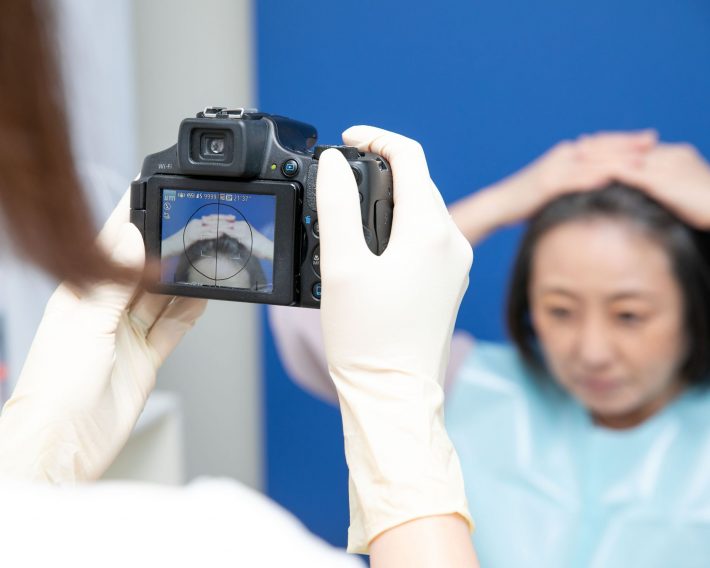 生え際と分け目を撮影