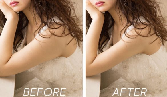 気になる二の腕など、細かな部分を修正できるプランもあるので安心！