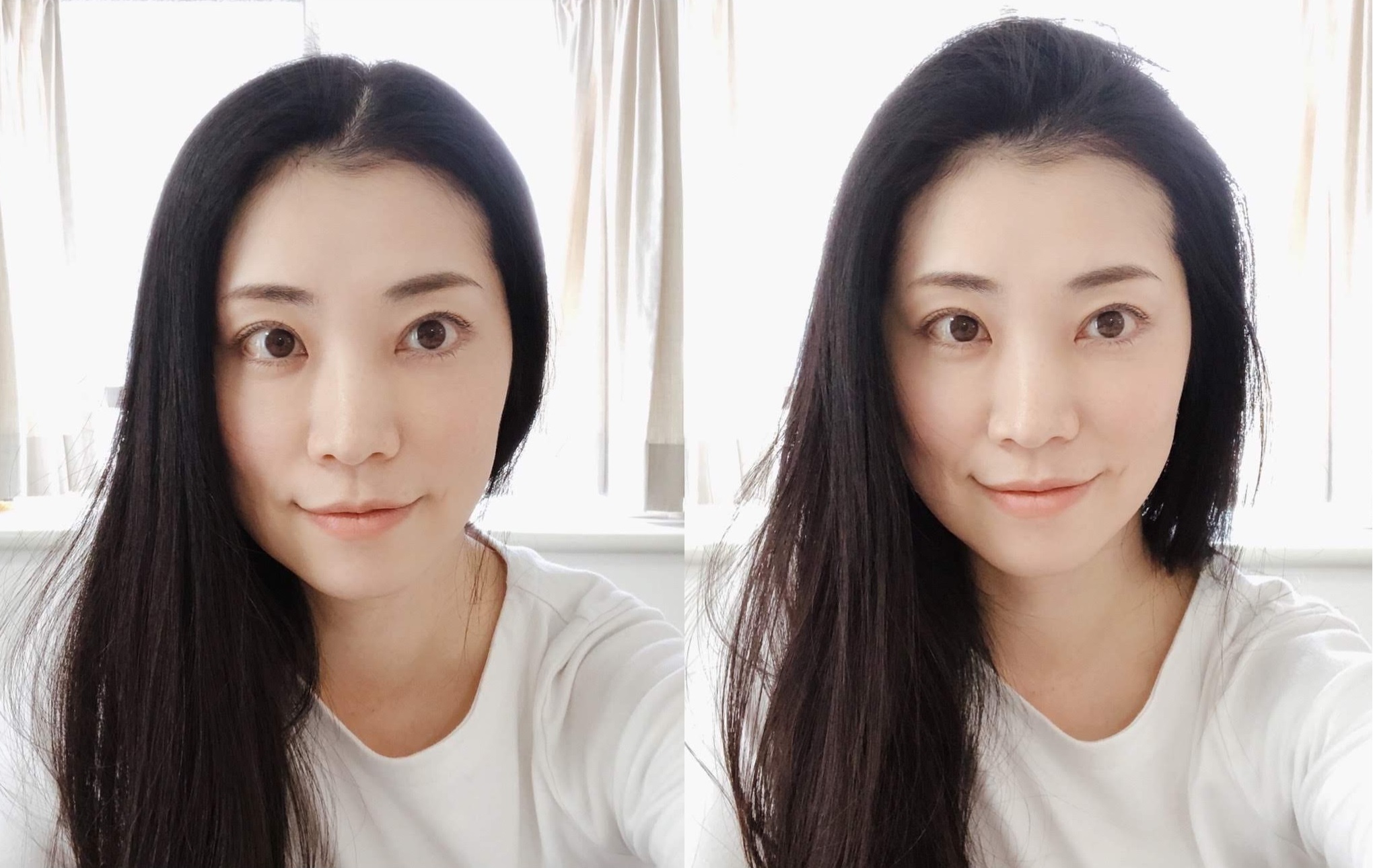 35歳すぎたら 女性の薄毛 は他人事じゃない ぺたんこ髪 で老け見えするわけ 女子spa ページ 2