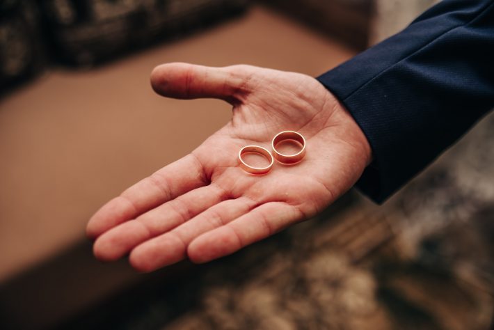 薬指にある傷跡、彼に「隠そうよ」と言われモヤッ