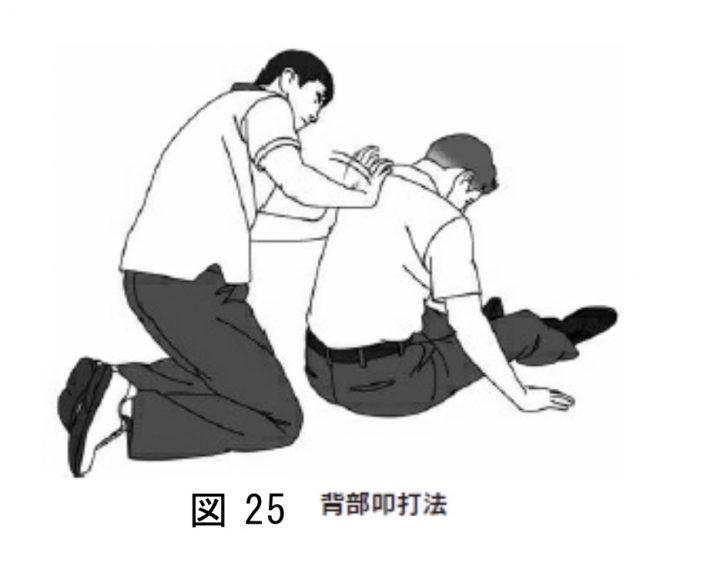 1歳以上の子どもに対する背部叩打（消費者庁「食品による子どもの窒息・誤嚥事故に注意！」より）