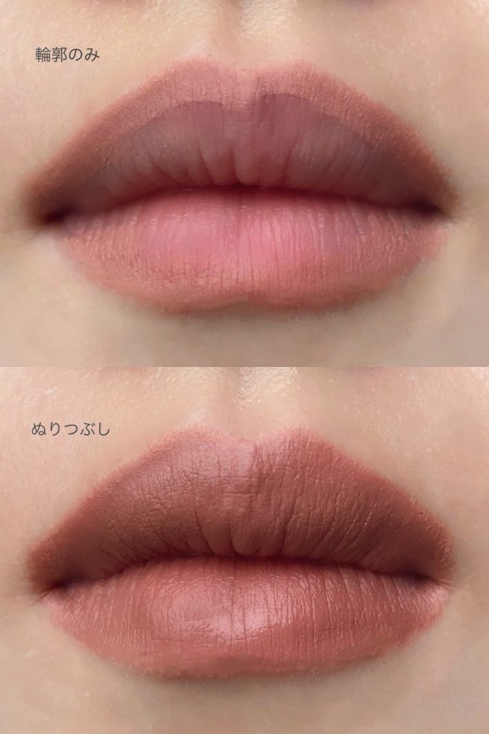 気になる口元の悩みをカバーする使い分け