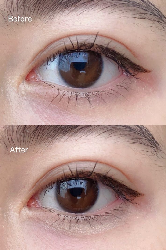 【ビフォー・アフター比較】リアル涙袋は本当につくれる？