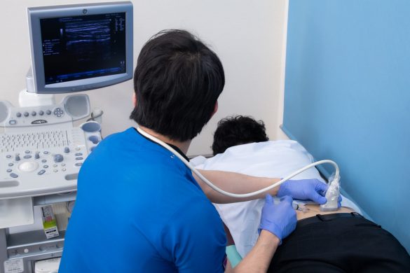 腰への筋膜リリース注射