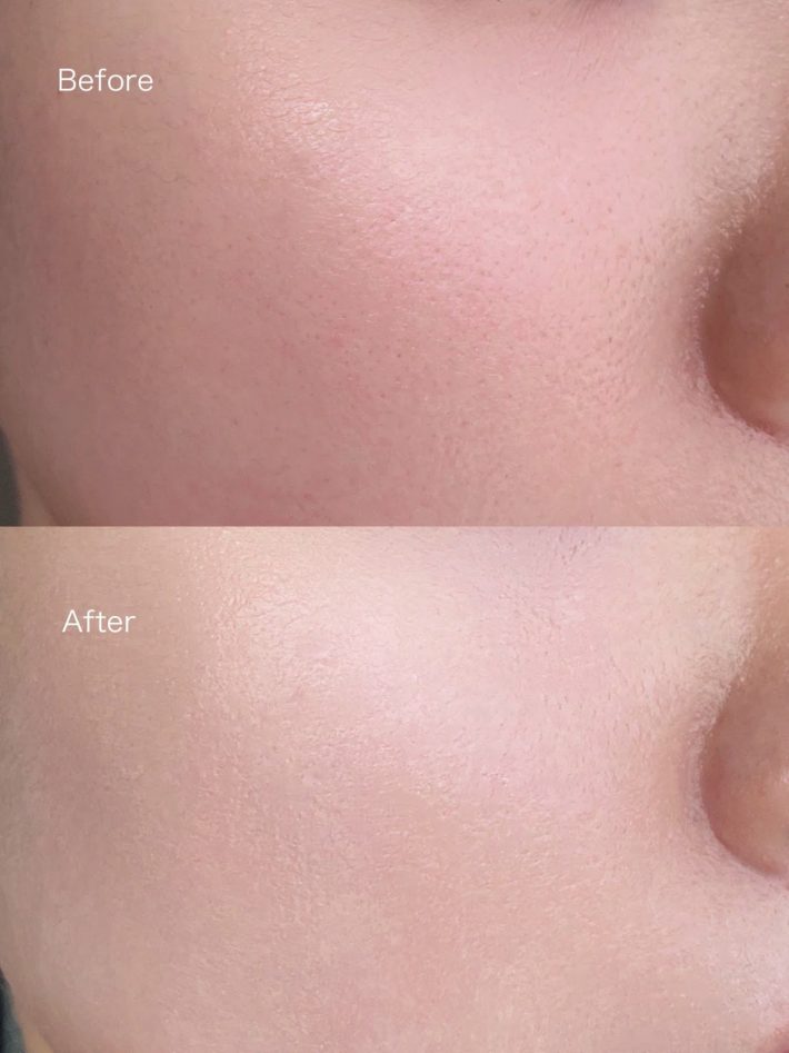 白浮きゼロのブライトニング効果