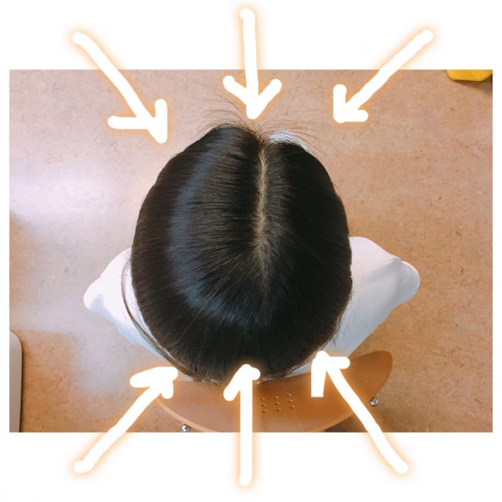 頭頂部の分け目