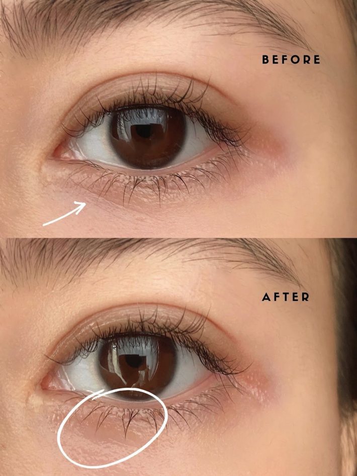 乾燥小じわを抜群の保湿力でふっくらと