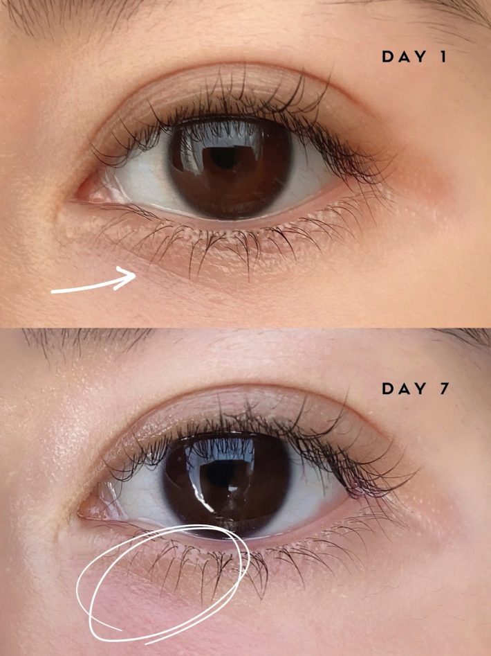 【1週間使ってみた】気になる目のシワの変化は？