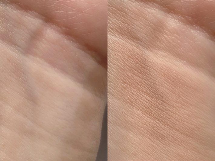 青い血管もここまでカバーできる！