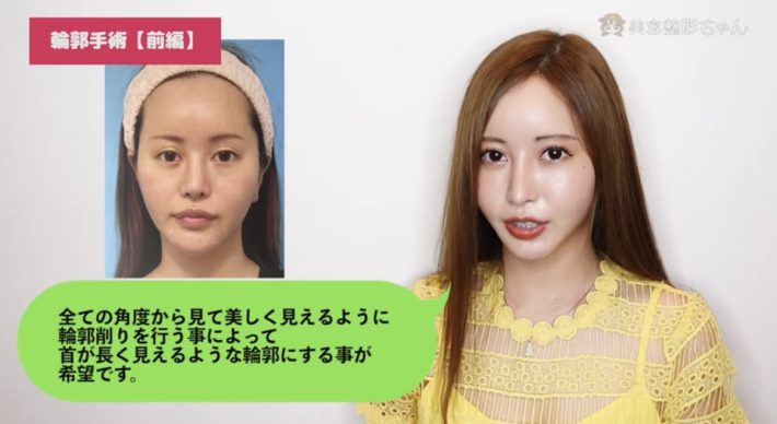 美容整形ちゃん