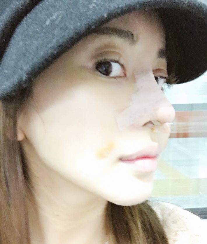 美容整形ちゃん