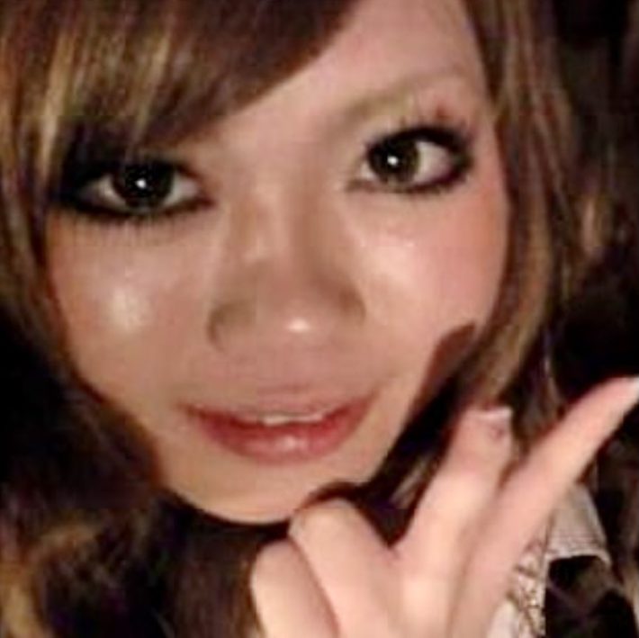 美容整形ちゃん