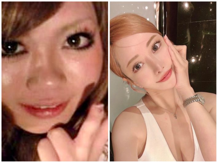 美容整形ちゃん