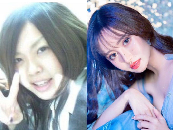 美容整形ちゃん