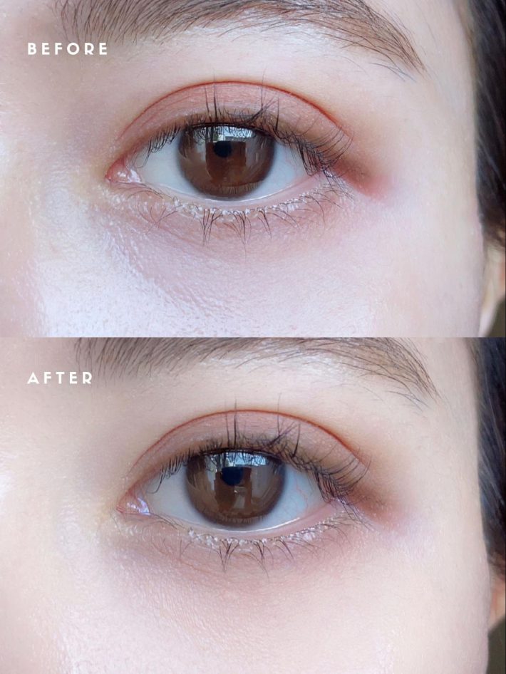 ビフォーアフター