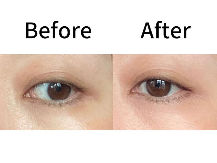 ヴィセ-クマカバー⑦