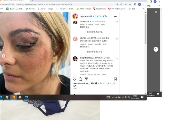 負傷した目元の写真