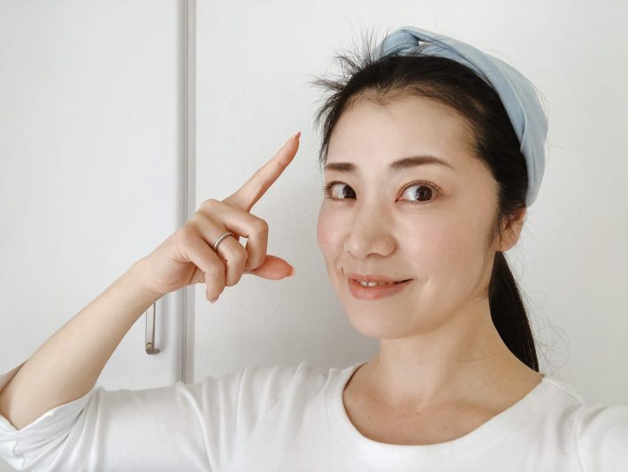 産後9ヶ月の生え際の状態