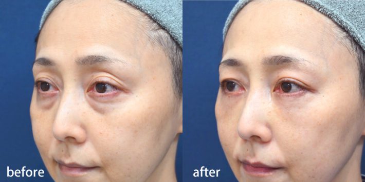 安嶋　康治先生