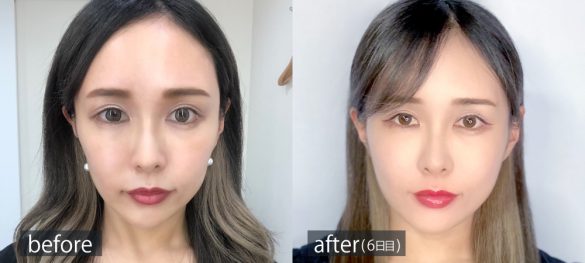 篠原　秀勝先生