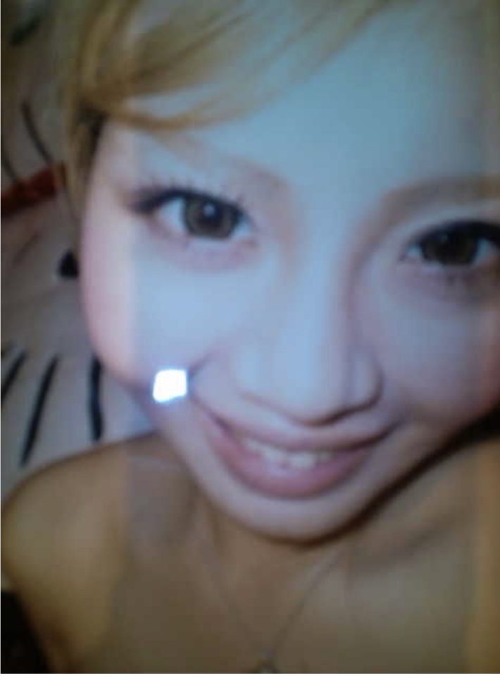 美容整形ちゃんヒアルロン酸