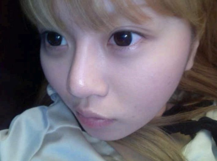 美容整形ちゃん