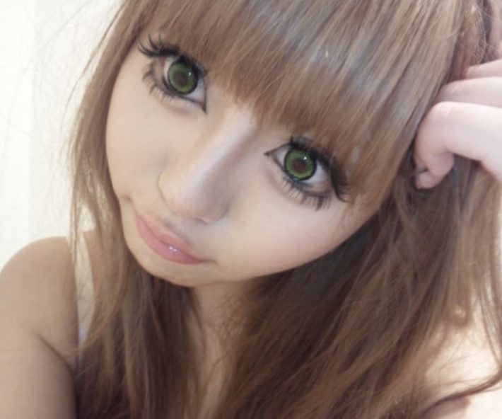 美容整形ちゃん