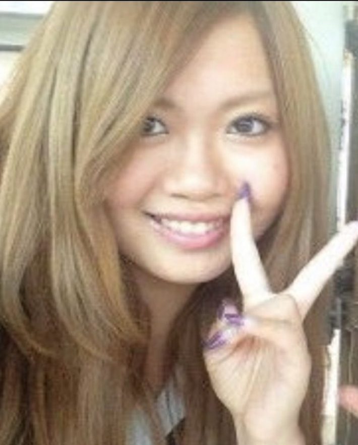 美容整形ちゃん整形前