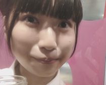 みこぴさま_二重整形後