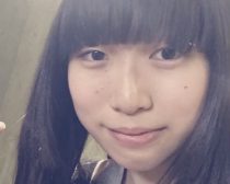 みこぴさま_整形前