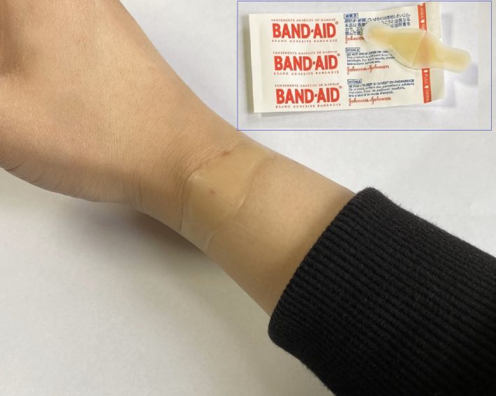 キズパワーパッド