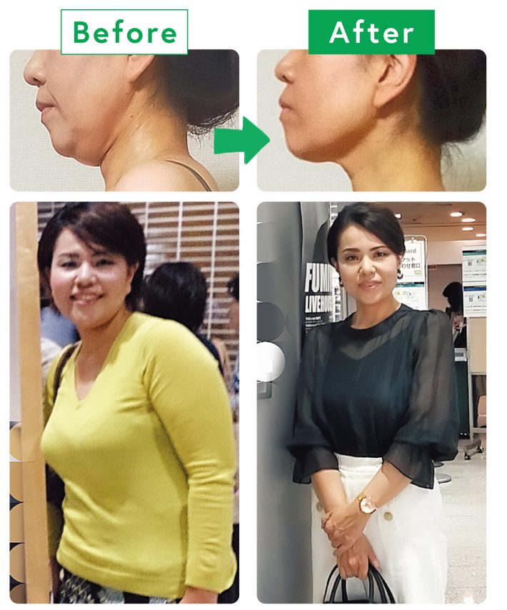 女性ビフォーアフター