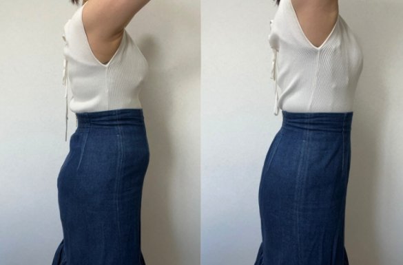 サイド:ビフォーアフター