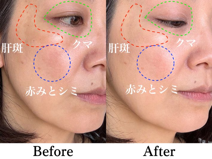 オールデイスキンフィットパールグロウクッション