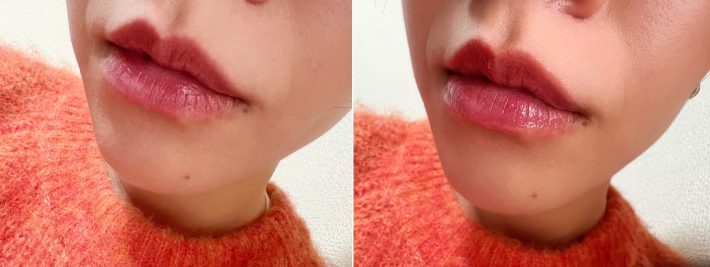 ビフォーアフター