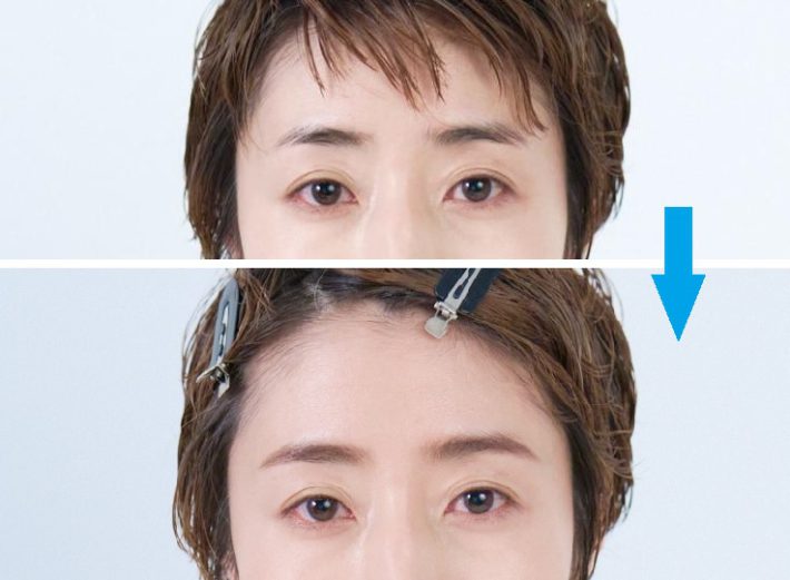 眉毛ビフォーアフター