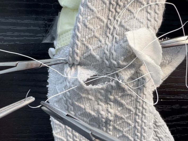 破れた娘さんのズボンを心臓手術用の糸で修理