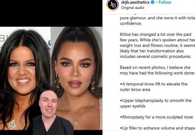 クロエの現在と過去の写真を比較・分析するジョニー・ベタリッジ氏