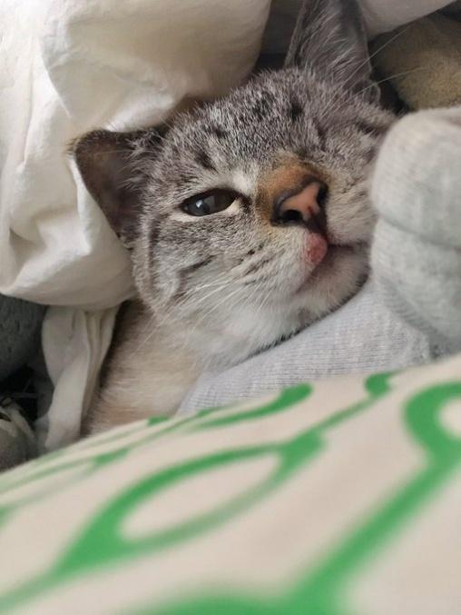 好酸球性肉芽腫でお口周りに炎症が…