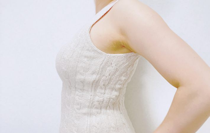 横から見たところ