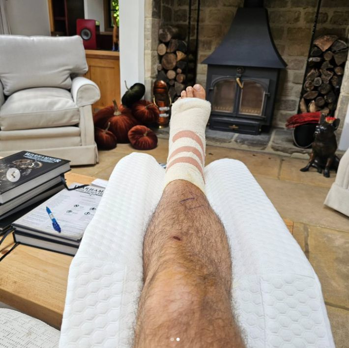 包帯でぐるぐる巻きにされた足を公開したヘンリー・カヴィル