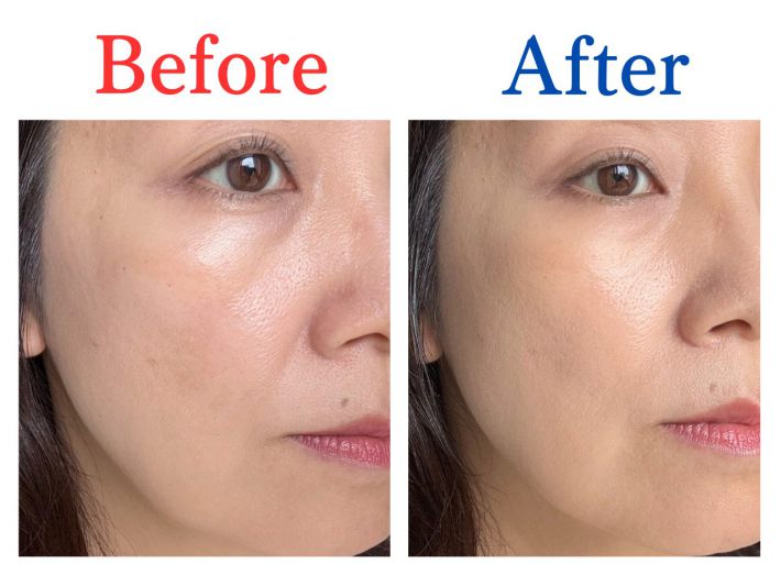 Before After エクセル エシリアル セラムコンシーラー