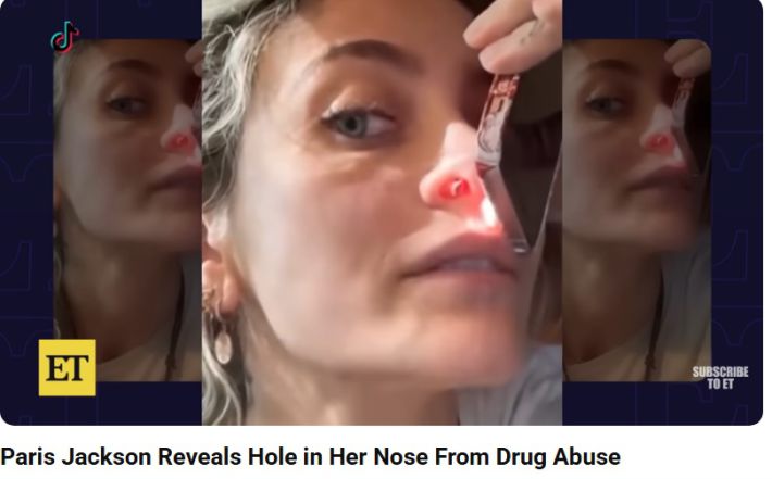 SNSに投稿した動画で鼻の中の穴を見せるパリス・ジャクソン