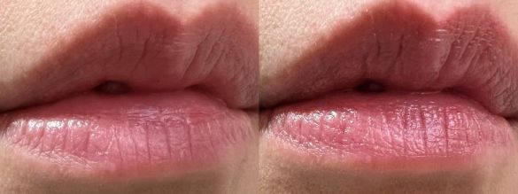 左：何も塗っていない状態、右：「薬用リップクリーム」を塗った状態