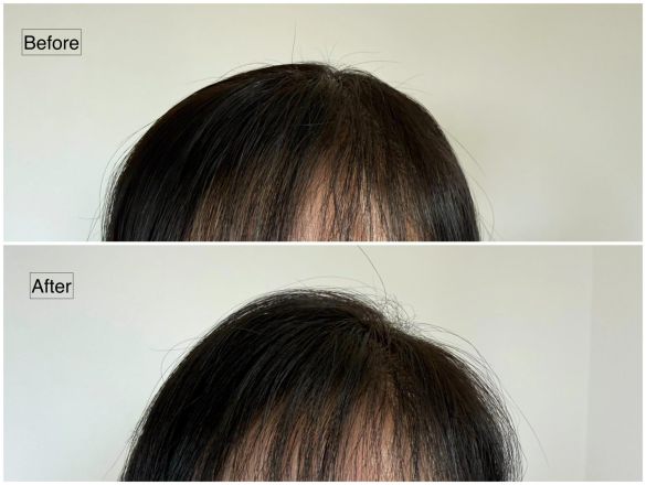 トップにボリュームがない