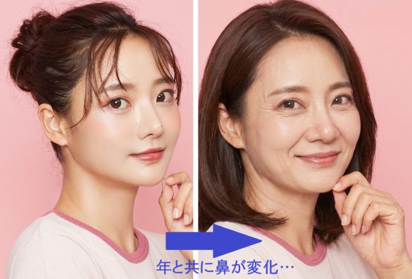 鼻の変化