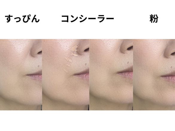 ほうれい線